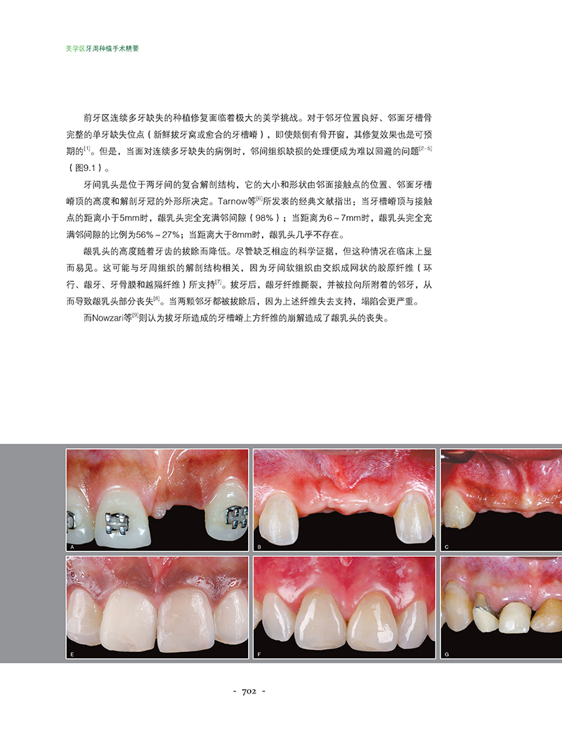 美学区牙周种植手术精要-精彩页2.jpg