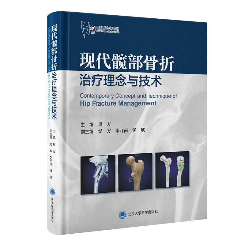 现代髋部骨折治疗理念与技术  主编 周方  北医出版