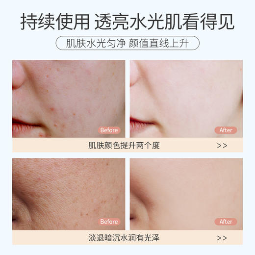 儒意补水面膜 烟酰胺保湿提亮肤色熬夜急救修复暗黄 商品图2