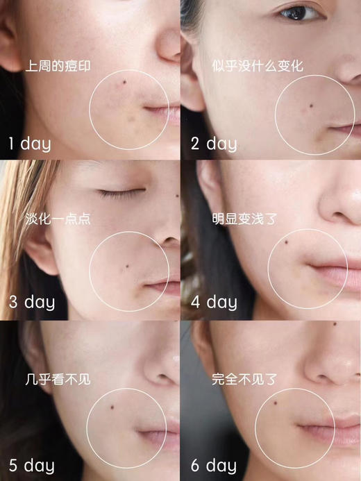 欧莱雅光子瓶美白淡斑精华30ml 商品图1