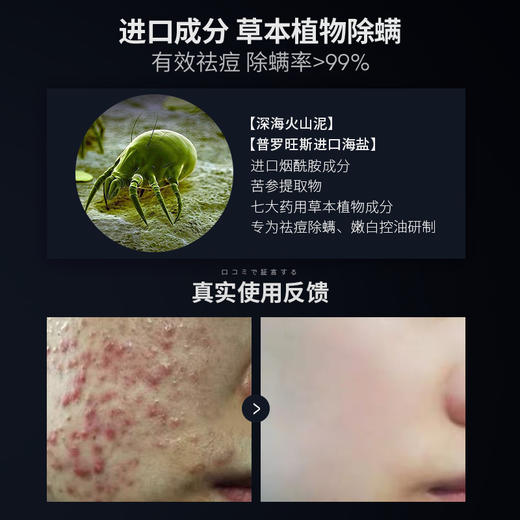 【第二瓶3折 温和不刺激】儒意火山泥洁面乳 清爽控油洗面奶 深层清洁粉刺男士面部护理 商品图3