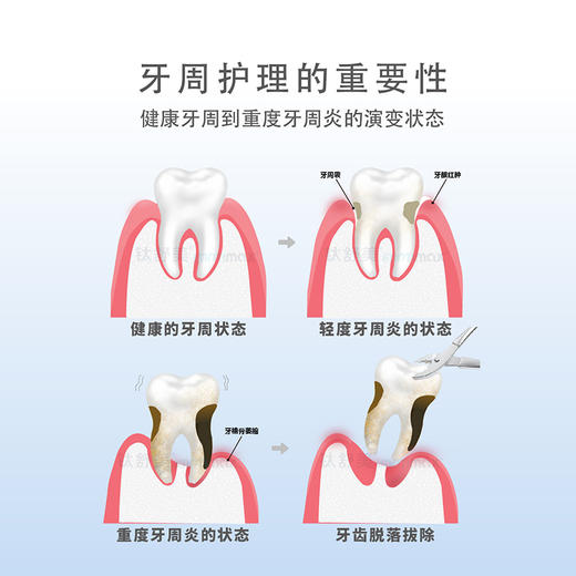 钛舒美牙周护理牙膏 商品图2