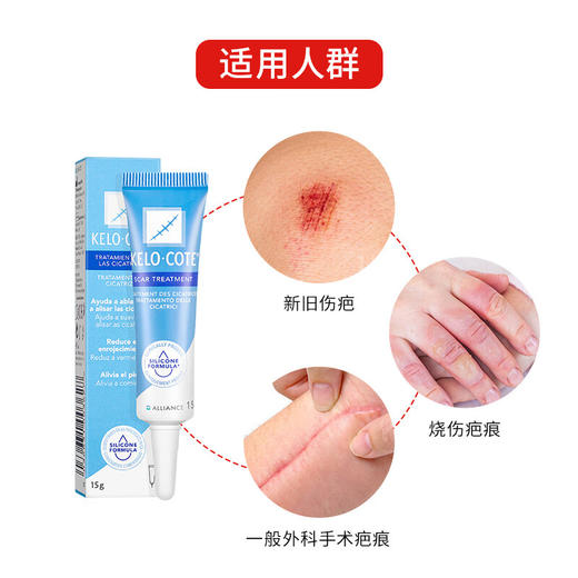 美国芭克祛疤痕修复凝胶15g 烫伤刨腹产祛疤淡疤修复 商品图1