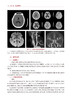 神经内科临床病例精解 徐运 陈晓春 十三五 专科医师能力提升导引丛书 供专业学位研究生及专科医师用人民卫生出版社9787117336888 商品缩略图4
