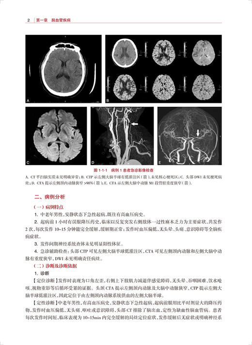 神经内科临床病例精解 徐运 陈晓春 十三五 专科医师能力提升导引丛书 供专业学位研究生及专科医师用人民卫生出版社9787117336888 商品图4