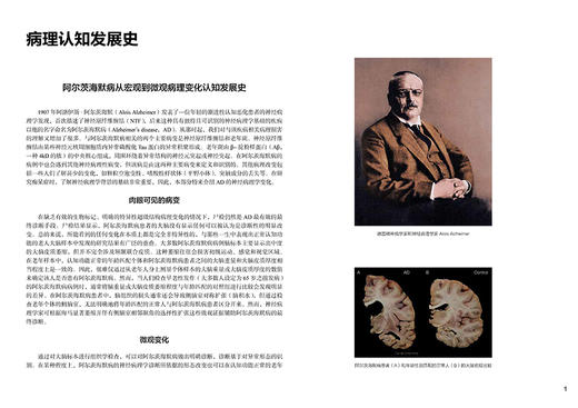 阿尔茨海默病脑超微结构病理图谱 小鼠版 王晓良 附视频 APP/PS1转基因小鼠模型 老年痴呆脑病理研究 人民卫生出版社9787117341981 商品图4