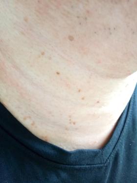  为什么淋巴会长小楸楸,你知道吗? 