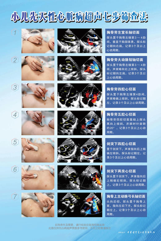 小儿先天性心脏病超声七步筛查法 叶菁菁主编 附视频 切面解剖检查方法注意事项超声诊断 中华医学电子音像出版社9787830053574 商品图2