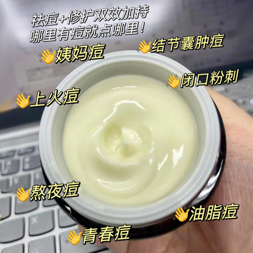 TOPC家用万能膏祛痘膏，青春痘、暗疮、各种痘痘，烧伤、烫伤、溃疡、脚气 商品图1