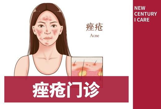 【皮肤科】痤疮门诊 商品图0