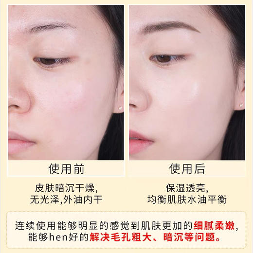 娇兰帝皇25X蜂皇水150ml/300ml 商品图6