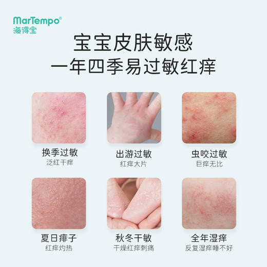 海得宝贻贝膏+金银花爽肤露|母婴放心用！快速祛红止痒 商品图11