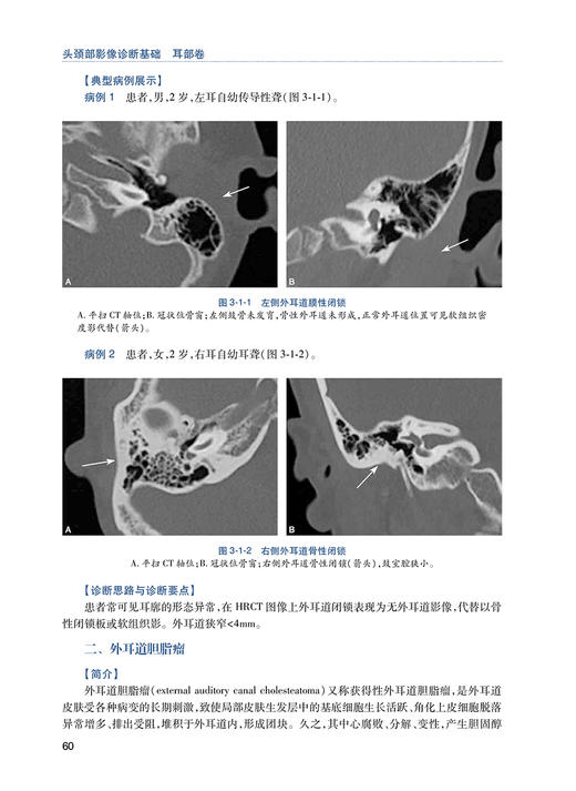 头颈部影像诊断基础 耳部卷 住院医师规范化培训丛书 临床放射科医生入门教材 沙炎 刘兆会 巩若箴 人民卫生出版社9787117327022 商品图4
