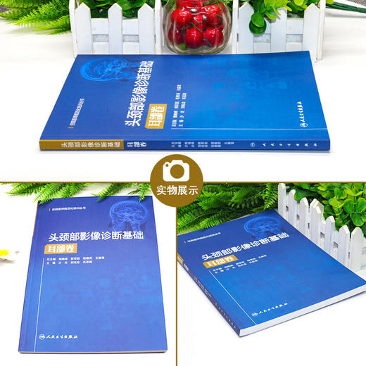 头颈部影像诊断基础 耳部卷 住院医师规范化培训丛书 临床放射科医生入门教材 沙炎 刘兆会 巩若箴 人民卫生出版社9787117327022 商品图2