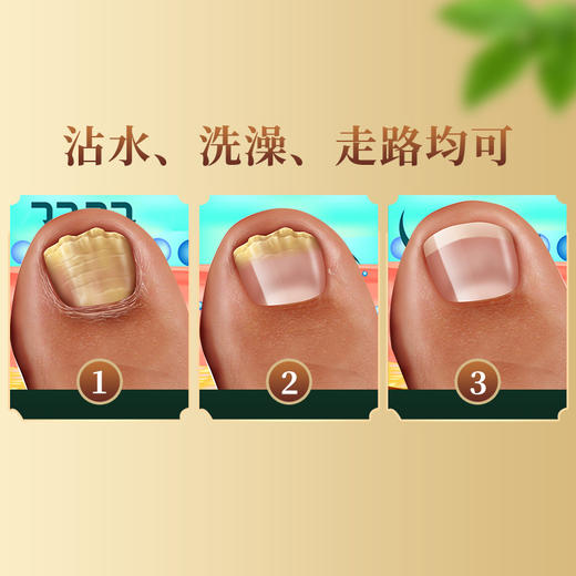 【买2送1】香港大药房甲姿迪灰指甲液体敷料 深层渗透 滋养甲床促养新甲 手足通用液体敷料灰甲液30ml/瓶 商品图3