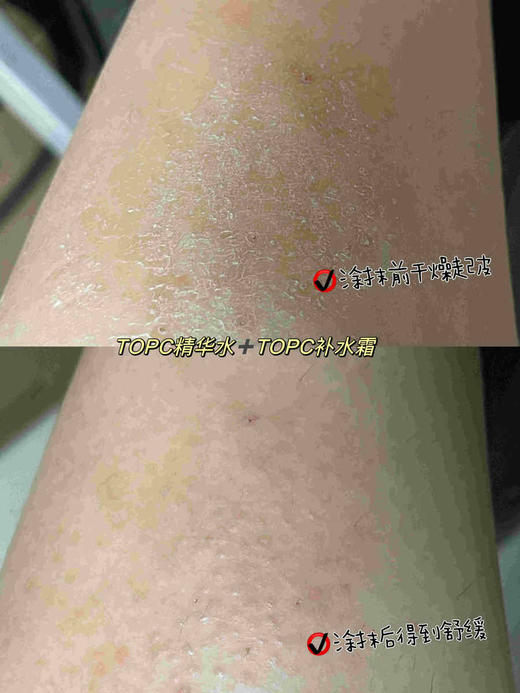 【TOPC益生元洋甘菊保湿霜】 50g 持久补水保湿 改善肌肤干燥 一抹即化成精华质感，调节皮肤微生态 塑造健康肌肤状态 大人小孩宝妈全家都能用 商品图8