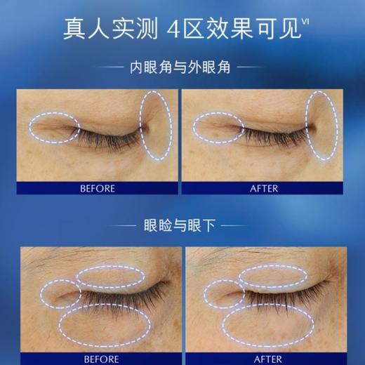 【 买一送一】雅诗兰黛第五代小棕瓶抗蓝光熬夜眼霜15ml淡化细纹黑眼圈 商品图4