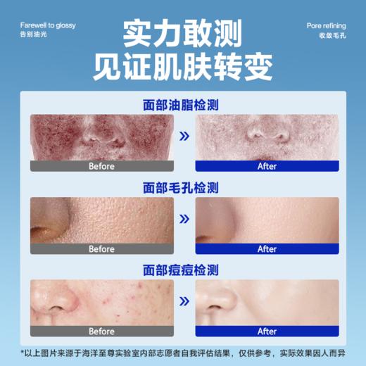 【新客专享】套海洋至尊蓝藻水能控油补水套盒 商品图4