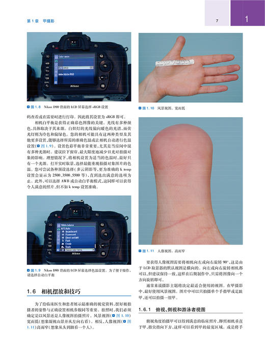 甲病 诊断手术治疗 第4版 陈宏翔 柴宝 病因诊治方案甲肿瘤Mohs手术 皮肤科手足外科临床工作者参考书9787117342094人民卫生出版社 商品图3