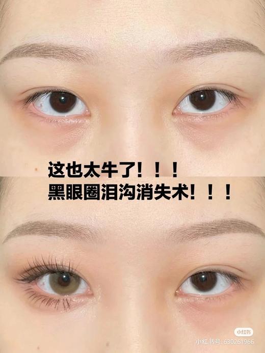 原价330 终结黑眼圈泪沟！1:1送刷子！新款毛戈平无瑕双色遮瑕膏811#自然遮眼袋法令纹 商品图4