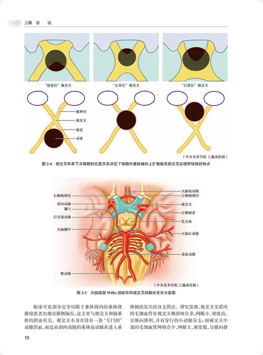 儿童视神经疾病 韦企平 施维 视神经视网膜组织胚胎 视路解剖 临床常见疾病 眼科医生研究生等参考书 人民卫生出版社9787117344494 商品图4