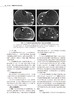 临床神经遗传病学 唐北沙主编 疾病临床表现医学遗传学特点 典型案例诊治 临床住院医师研究生参考书 人民卫生出版社9787117337595 商品缩略图4