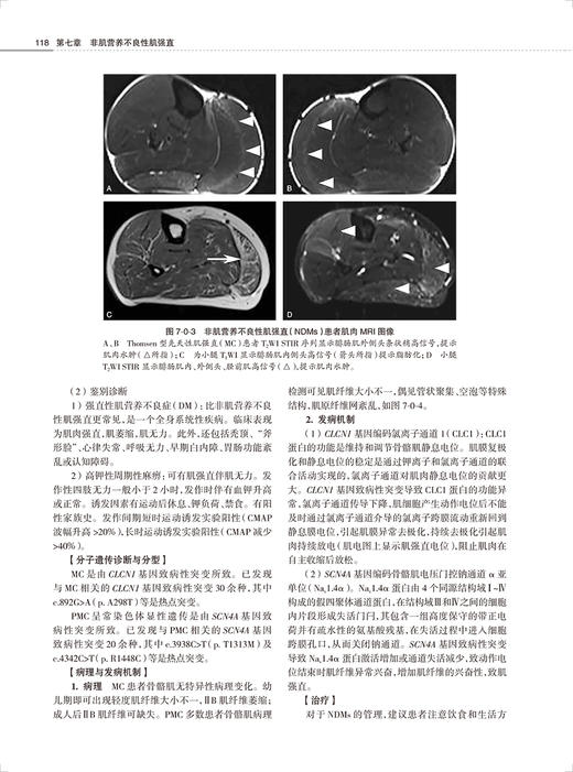 临床神经遗传病学 唐北沙主编 疾病临床表现医学遗传学特点 典型案例诊治 临床住院医师研究生参考书 人民卫生出版社9787117337595 商品图4