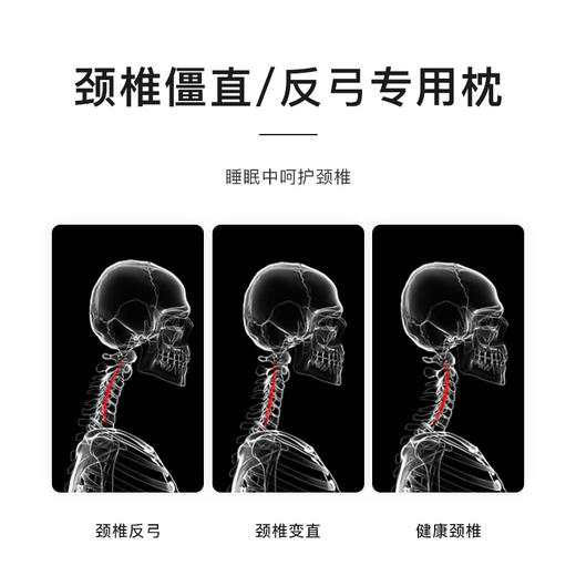 【德国IGR人体工学认证】祺加质品颈椎牵引枕 德国巴斯夫进口记忆棉 慢回弹物理拉伸 颈椎与头部科学分区 21味草药热敷 四档温度定时调节 放心好睡眠 商品图3