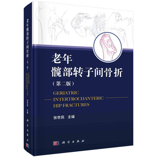 老年髋部转子间骨折/张世民 商品图0