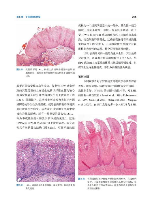 Blaustein女性生殖道病理学 第7版 薛德彬主译 病种临床表现诊断治疗 妇产科病理住院医师参考书 北京科学技术出版社9787571425012 商品图3