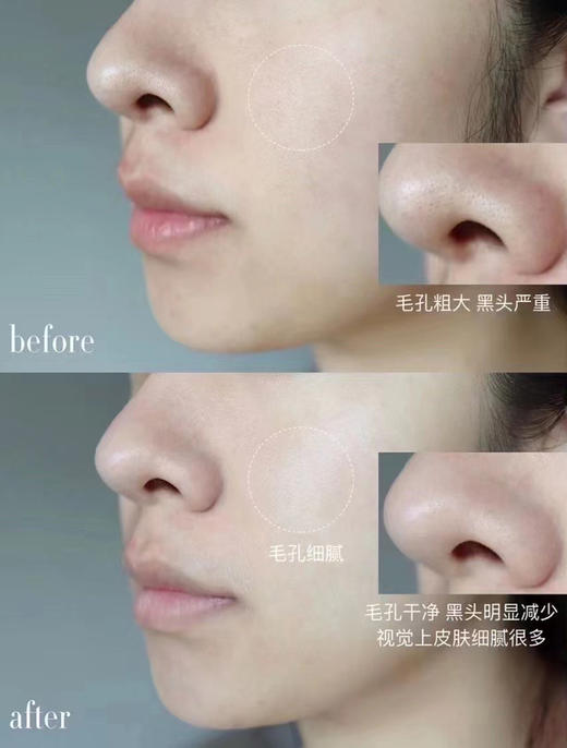 毛孔吸尘器！科颜氏白泥控油面膜中样14ml 深层清洁去黑头粉刺 商品图7