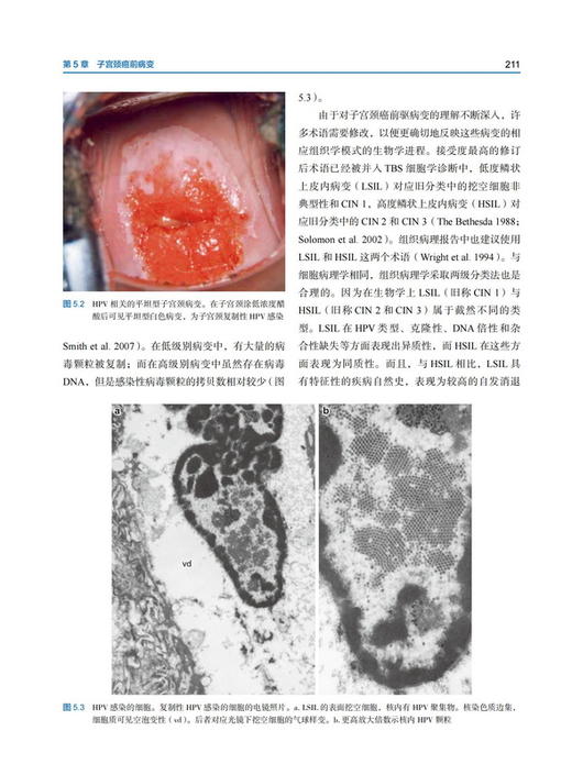 Blaustein女性生殖道病理学 第7版 薛德彬主译 病种临床表现诊断治疗 妇产科病理住院医师参考书 北京科学技术出版社9787571425012 商品图4