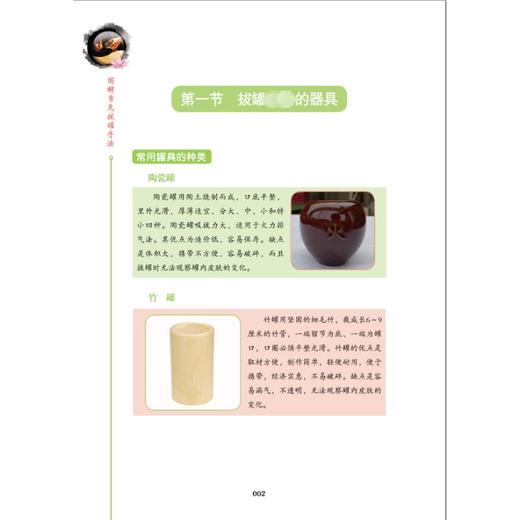 图解常见拔罐手法 商品图4