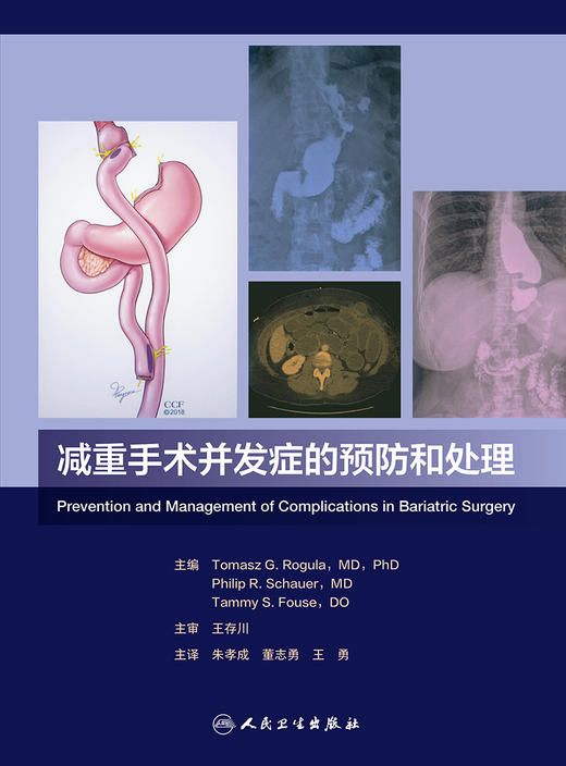 减重手术并发症的预防和处理 2023年3月参考书 9787117342490 商品图1