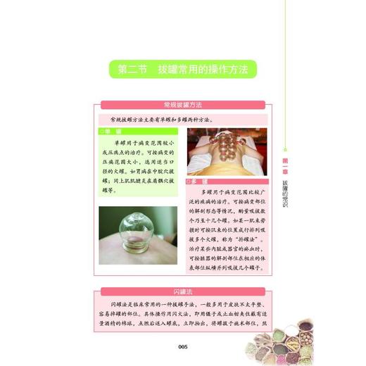 图解常见拔罐手法 商品图3