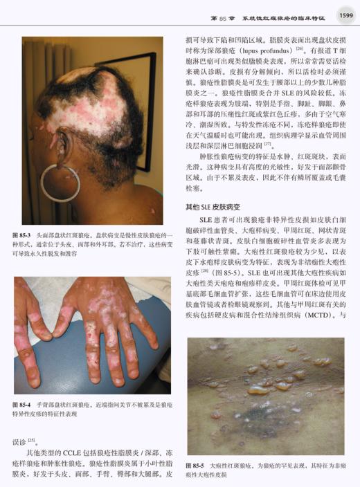 凯利风湿病学 第11版 上下卷 栗占国主译 成人儿童风湿性疾病诊断筛查治疗方法 综合全面讲解  北京大学医学出版社9787565927683 商品图4