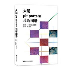 《大肠pit pattern诊断图谱》