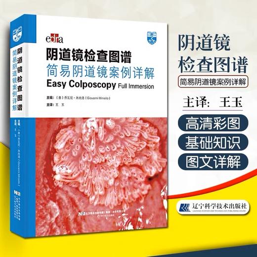 《阴道镜检查图谱：简易阴道镜案例详解》 商品图0