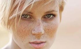  天天闹着祛斑，却忽视了最重要的3点！ 