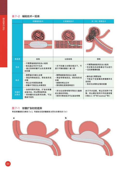 脑血管内治疗 吉村绅一 高木俊范 主编 温志锋 王春雷 胡鹏 主译 辽宁科学技术出版社 9787559127303 商品图4