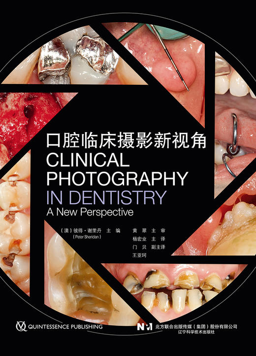 口腔临床摄影新视角 彼得谢里丹 主编 杨宏业 主译 口腔数码影像 标准临床影像指南 后期处理 辽宁科学技术出版社 9787559128089 商品图1