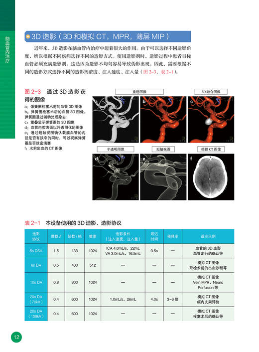 脑血管内治疗 吉村绅一 高木俊范 主编 温志锋 王春雷 胡鹏 主译 辽宁科学技术出版社 9787559127303 商品图3