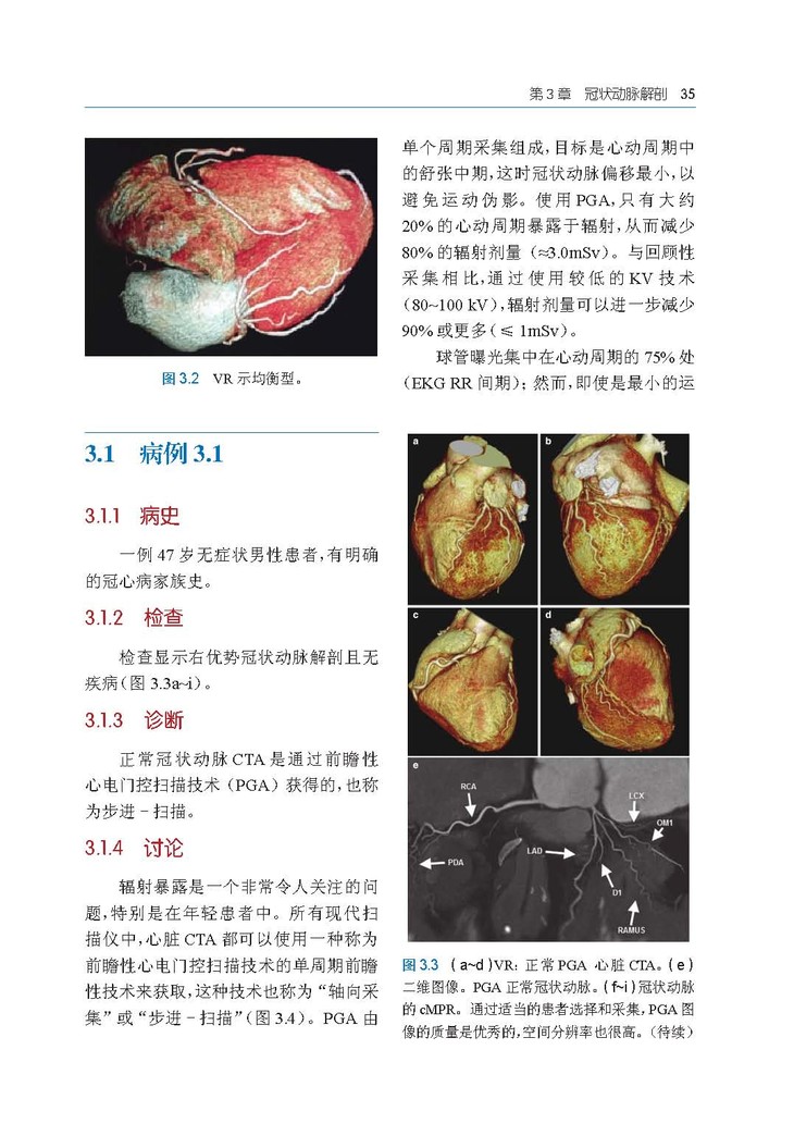 冠状动脉CTA:病例图解第3章_Page_05.jpg