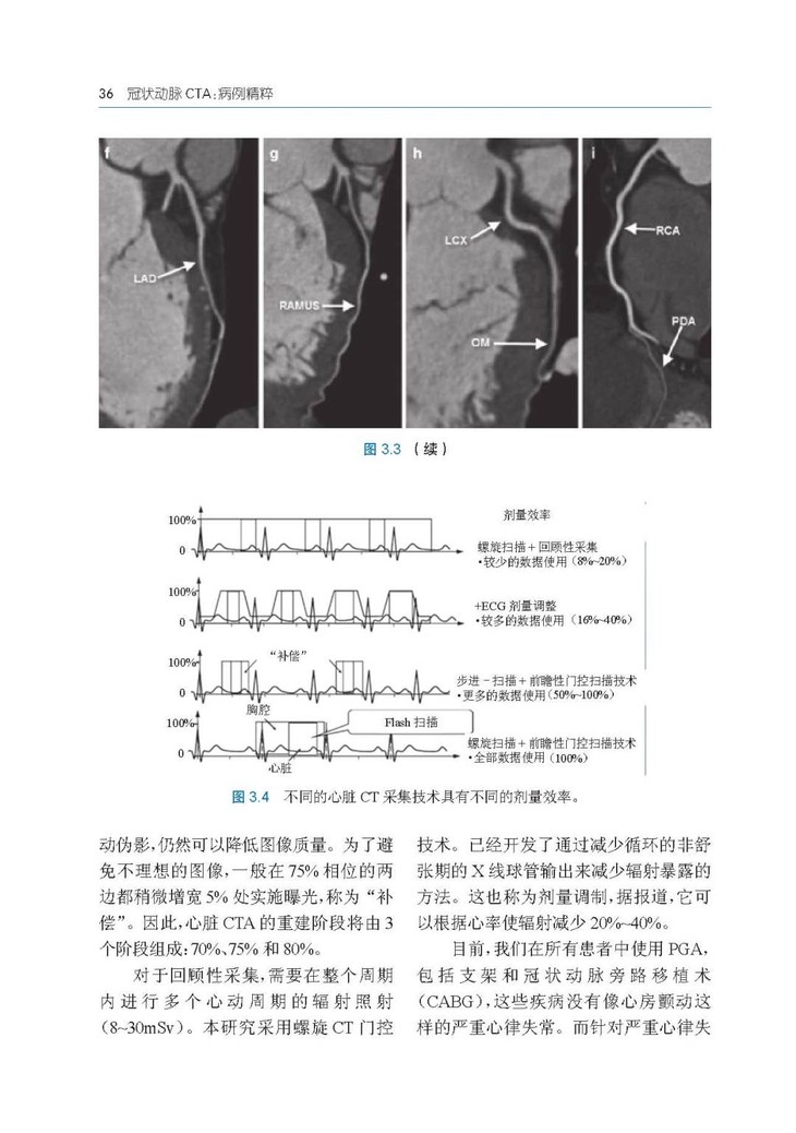 冠状动脉CTA:病例图解第3章_Page_06.jpg