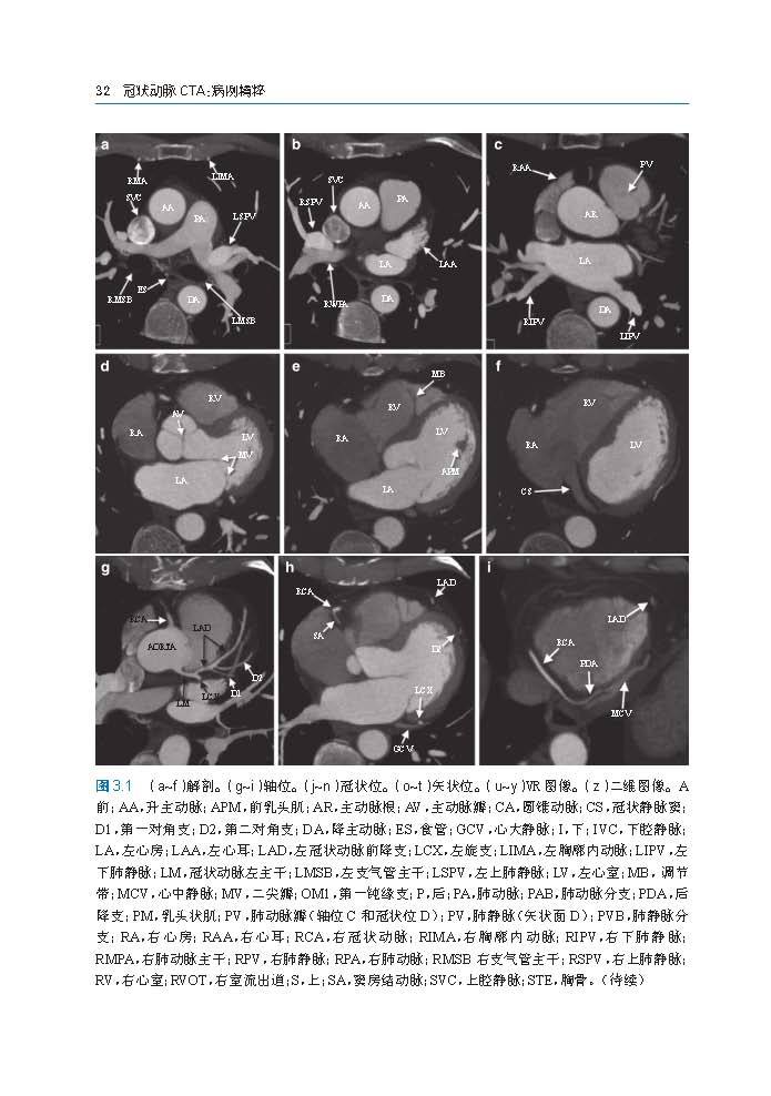 冠状动脉CTA:病例图解第3章_Page_02.jpg