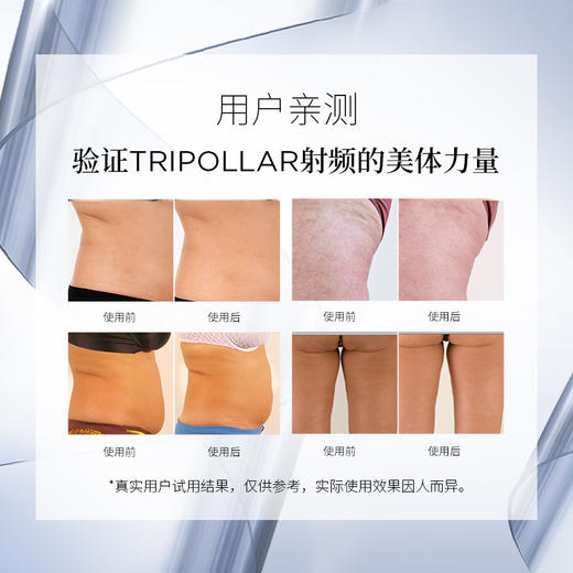 5折福利 以色列Tripollar POSE 塑形仪 商品图2