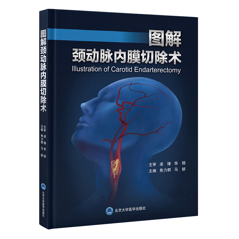 图解颈动脉内膜切除术  焦力群　马妍 主编  北医社