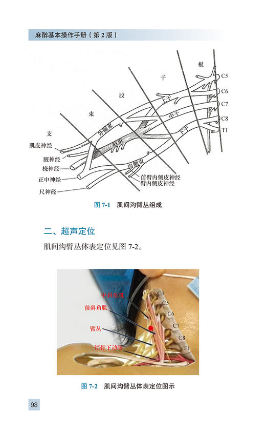 麻醉基本操作分册 第2版 冯艺主编 附视频 临床麻醉系列丛书 临床常用麻醉基本操作 零基础入门 北京大学医学出版社9787565927461 商品图3