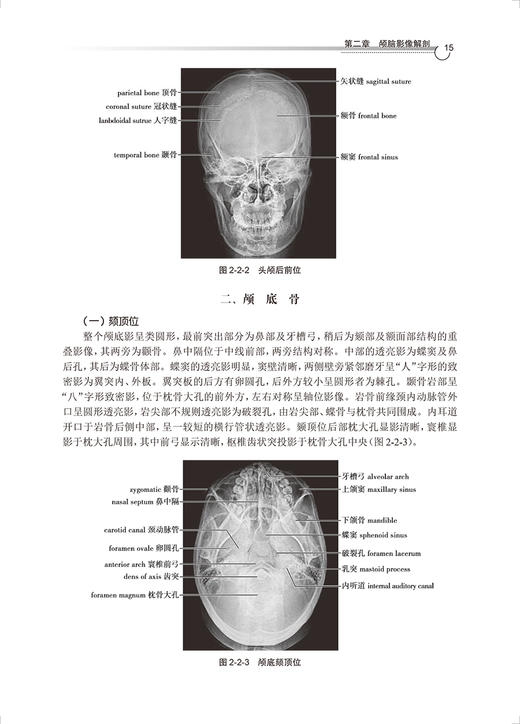 医学影像解剖学 第2版 胡春洪 王冬青 全国高等学校教材 江苏省高等学校重点教材 供医学影像专业用 人民卫生出版社9787117344395 商品图4