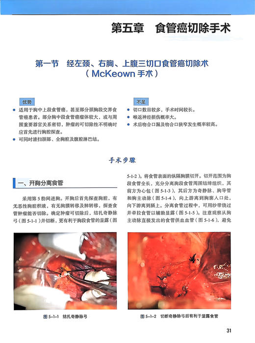 食管癌规范化手术 杨跃主编 配视频 临床肿瘤治疗 外科解剖手术入路要点注意事项 并发症防治 北京大学医学出版社9787565927874 商品图4